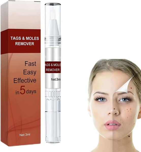 Tags and moles remover